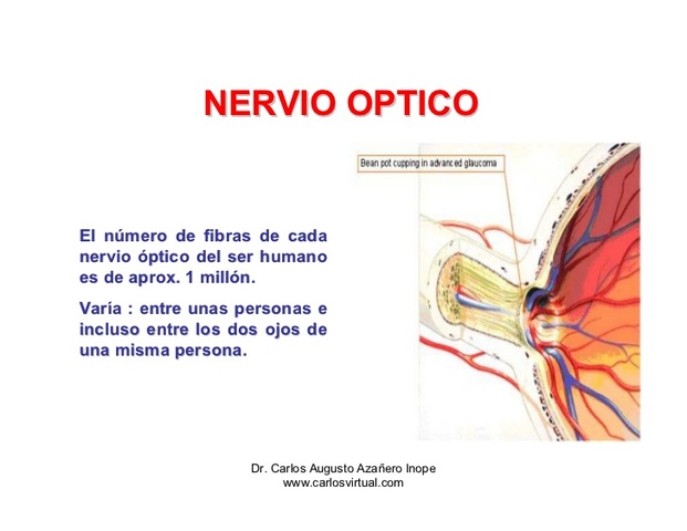Nervio Óptico