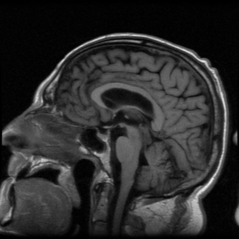 Resultados de la caracterizacion