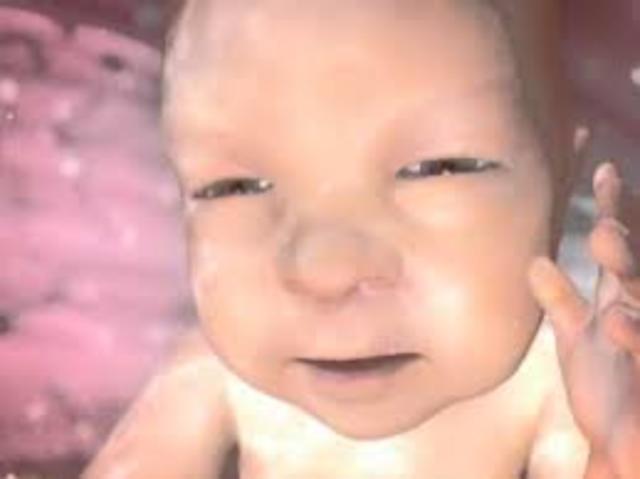 Vigésima octava semana: El feto abre los ojos