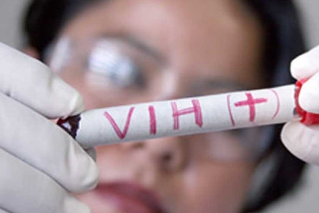 Identifican el virus que causa el SIDA