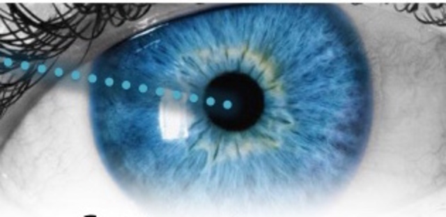 LASIK eye surgery