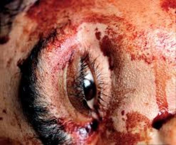 The Morgue (Hacked to Death I) by Andres Serrano