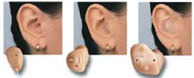 In-the-Ear-Canal Hearing Aids