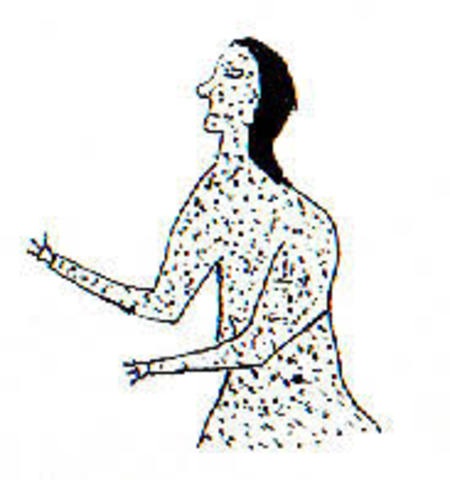 The Columbian Exchange: Diseases