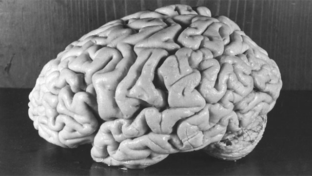 EINSTEIN BRAIN