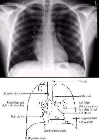 Met with Surgeon. Had chest x-ray and bloodwork