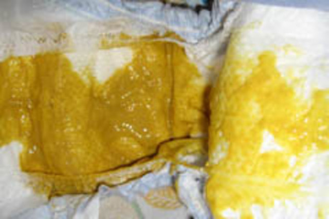 Mijn eerste schijtsessie