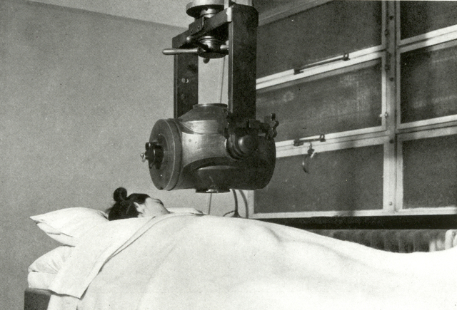 First External Beam Radium Device Developed