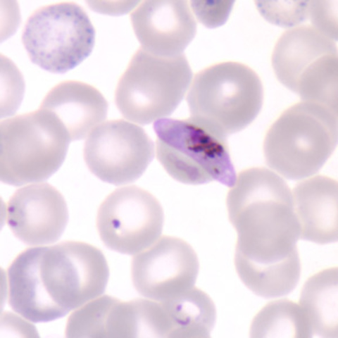 Plasmodium falciparum described