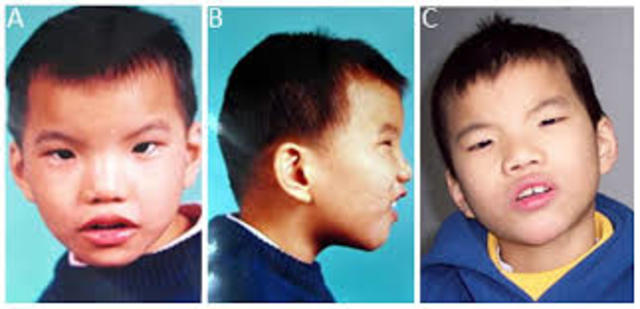 Enfermedades Hereditarias