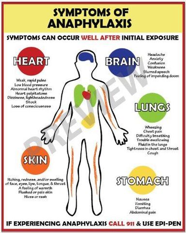 Anaphylactic Shock