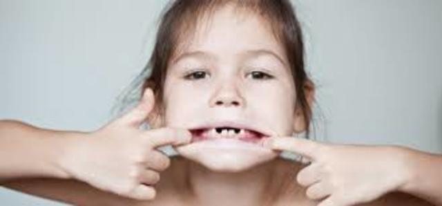 Em cau la primera dent