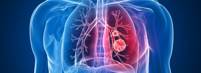 Ingressada per neumònia