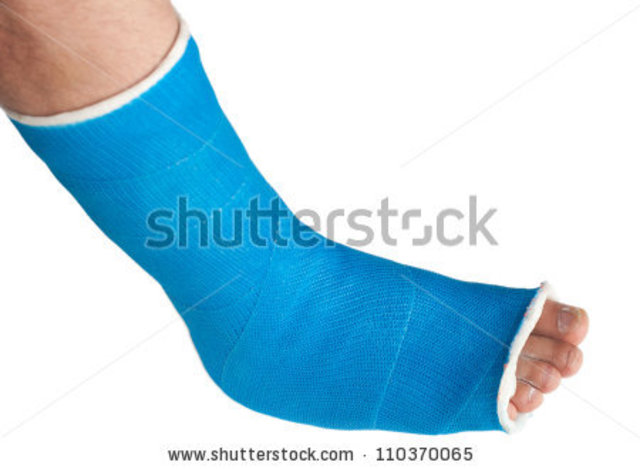 broken foot