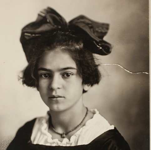 Contrajo Poliomielitis 5