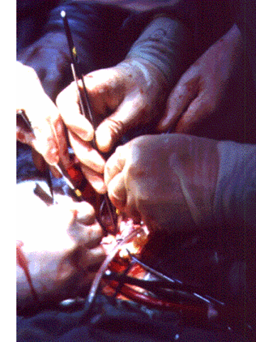 Technological Advances