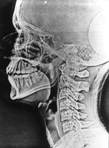 Raigs X ( Wilhelm Rontgen )