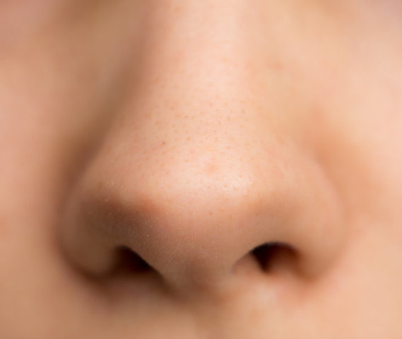 My Nose