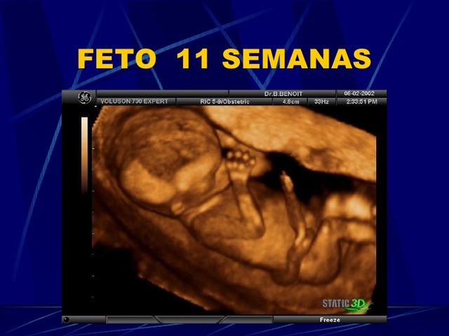 Semana 10 a 11