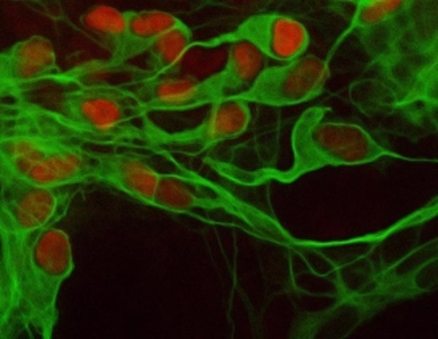 El experimento de clonación utilizando células no embrionarias, en concreto, células del revestimiento intestinal del renacuajo.