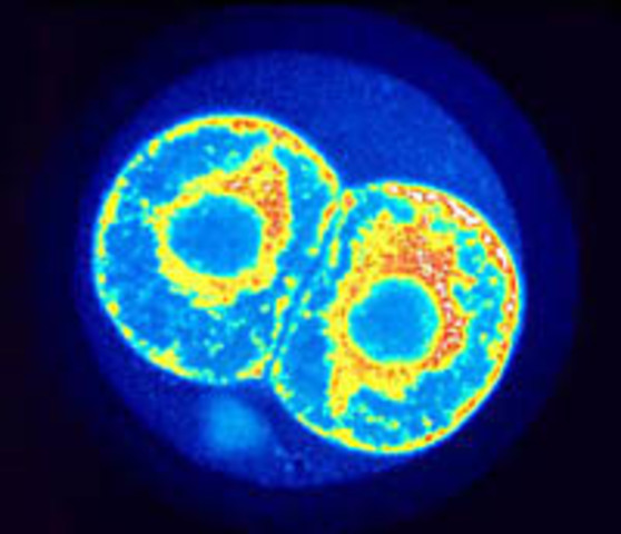 Rudolf Virchow - Todas las células provienen de otras células.