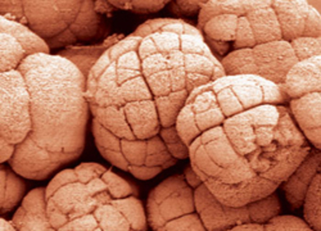 PRIMEROS SERES UNICELULARES