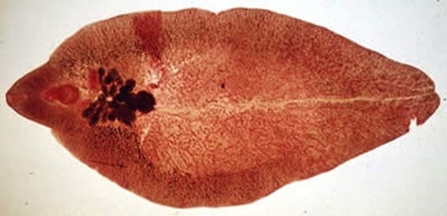 Fasciola Hepática