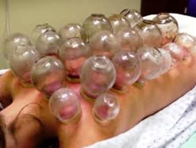 Métodos  para tratar las enfermermedades mentales