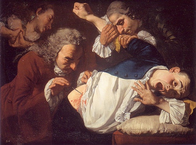 Le Tableau de l’Opération de la Taille - Marin Marais