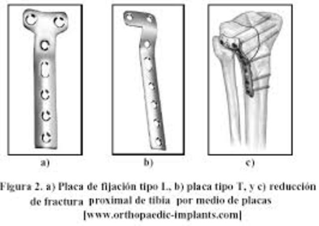 Utilización de placas de acero