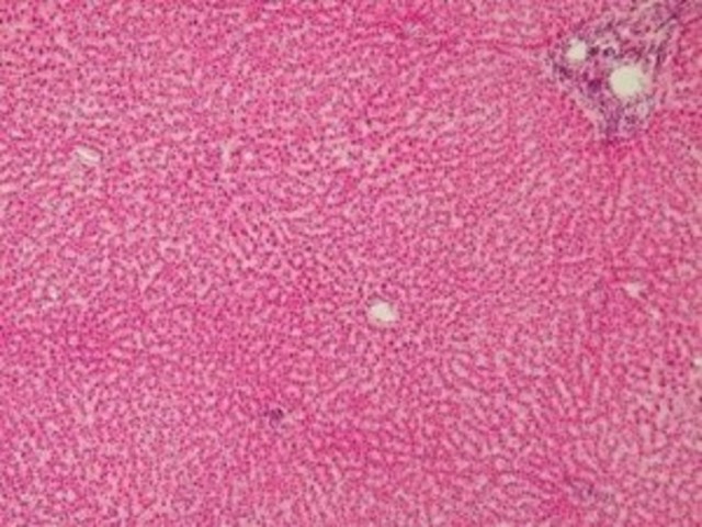 Demuestran como el virus de la hepatitis sobrevive en el hígadp