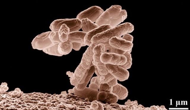 Diseño de E. coli semisintética