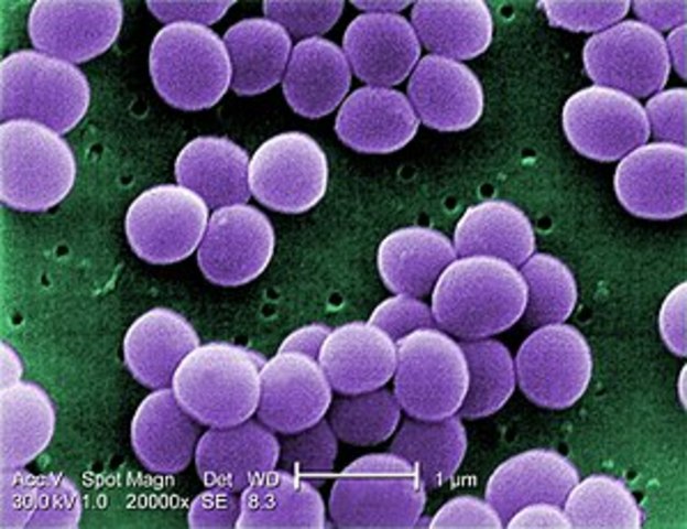 Vacuna contra Staphylococcus aureus