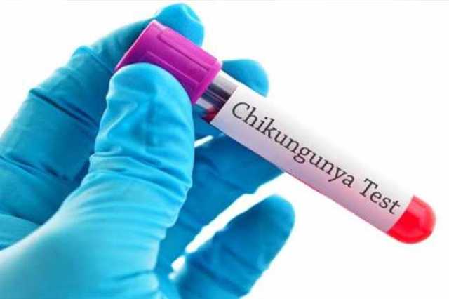 Prototipo de la vacuna contra Chikungunya