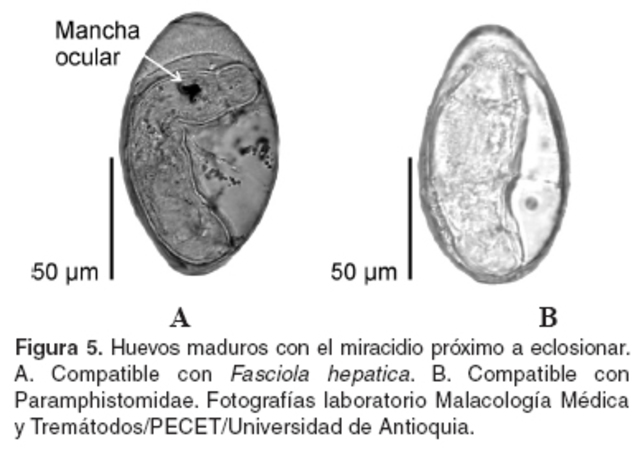 Fasciolosis y paramfistomosis en bovinos