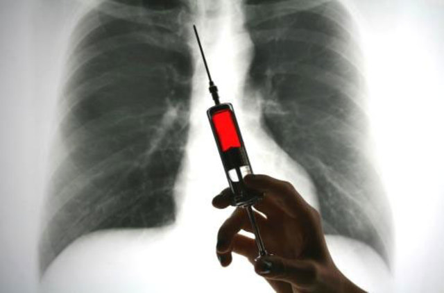 Vacuna contra el cáncer de pulmón