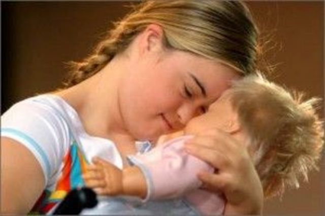 EVOLUCIÓN DE RETRASO MENTAL