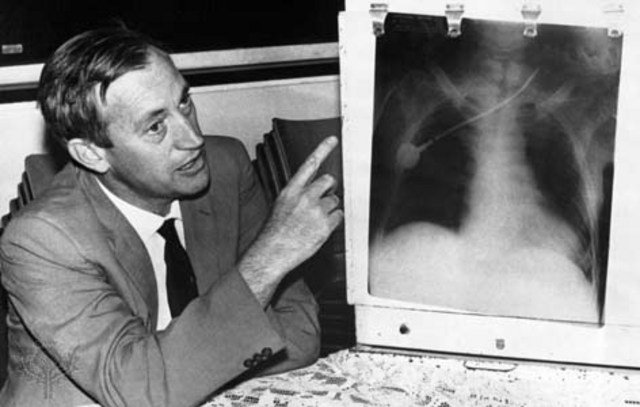 First Heart Transplant