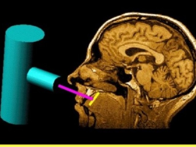 Instrumento de localización.
