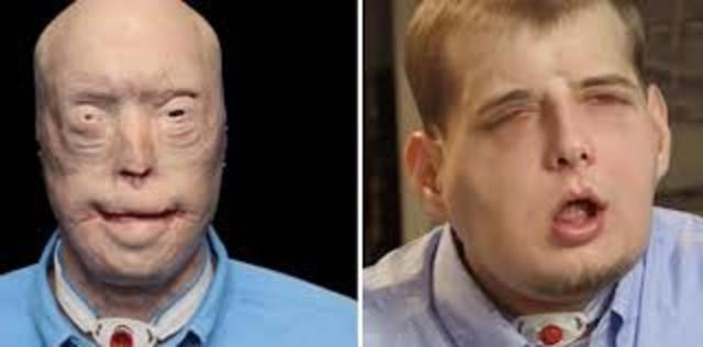 The man with the deformed face.