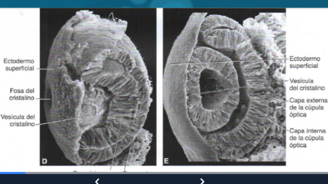 6 SEMANAS DE GESTACIÓN