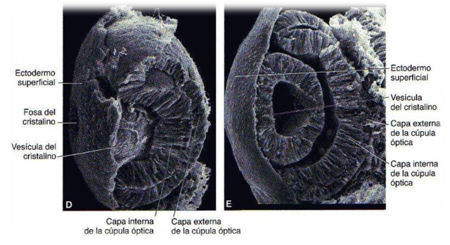 7ma Sem. Cristalino y Quiasma óptico