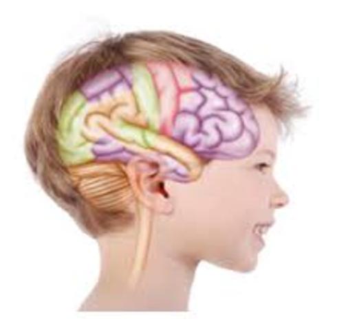 Cerebro de 1 año de vida