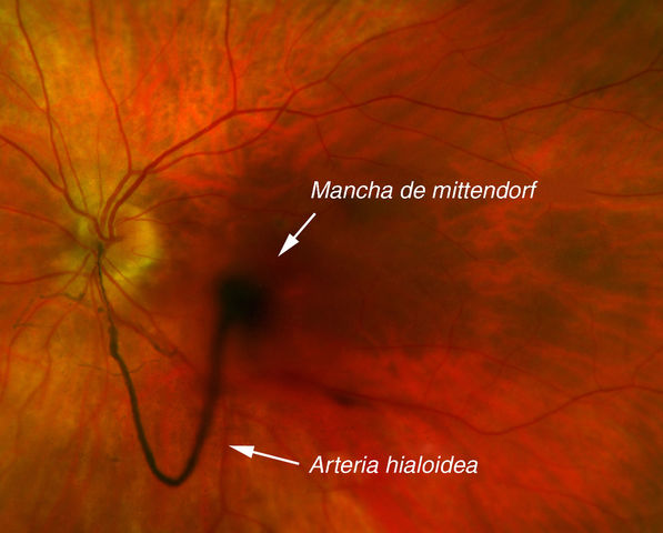 6° SEMANA(CULMINAR)
