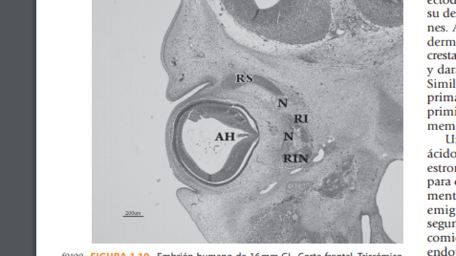 Cuarta semana de gestación.