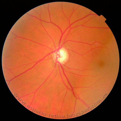 8 semana Columnas de glioblastos en el nervio óptico intraocular Cuerpo vítreo secundario Estadio de yema epitelial de la glándula lagrimal