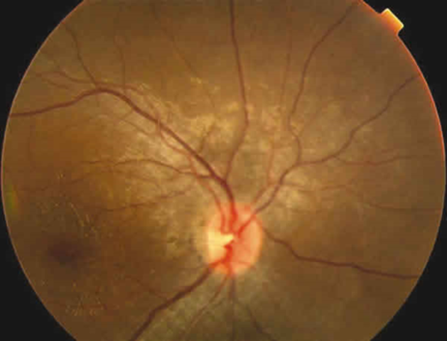 Noveno mes de gestación