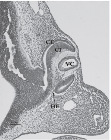 Cúpula óptica, cristalina, hendidura embrionaria
