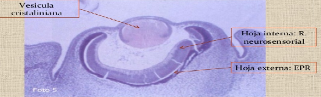 retina neurosensorial.