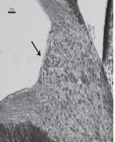 Hendidura embrionaria cerrada